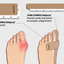 Bunion Relief Tape