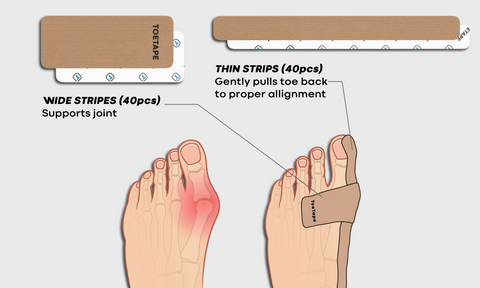 Bunion Relief Tape